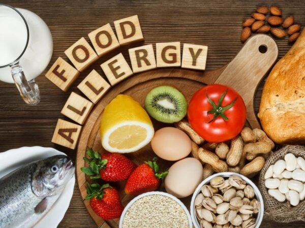Food-Allergens